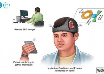 کلاه هوشمند از تشنج مغزی بعد از جراحی جلوگیری می&zwnjکند