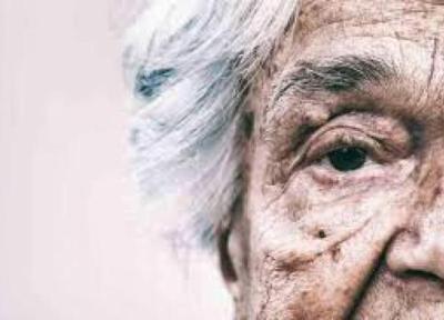 بیماری های پوستی کیفیت زندگی سالمندان را می کاهد